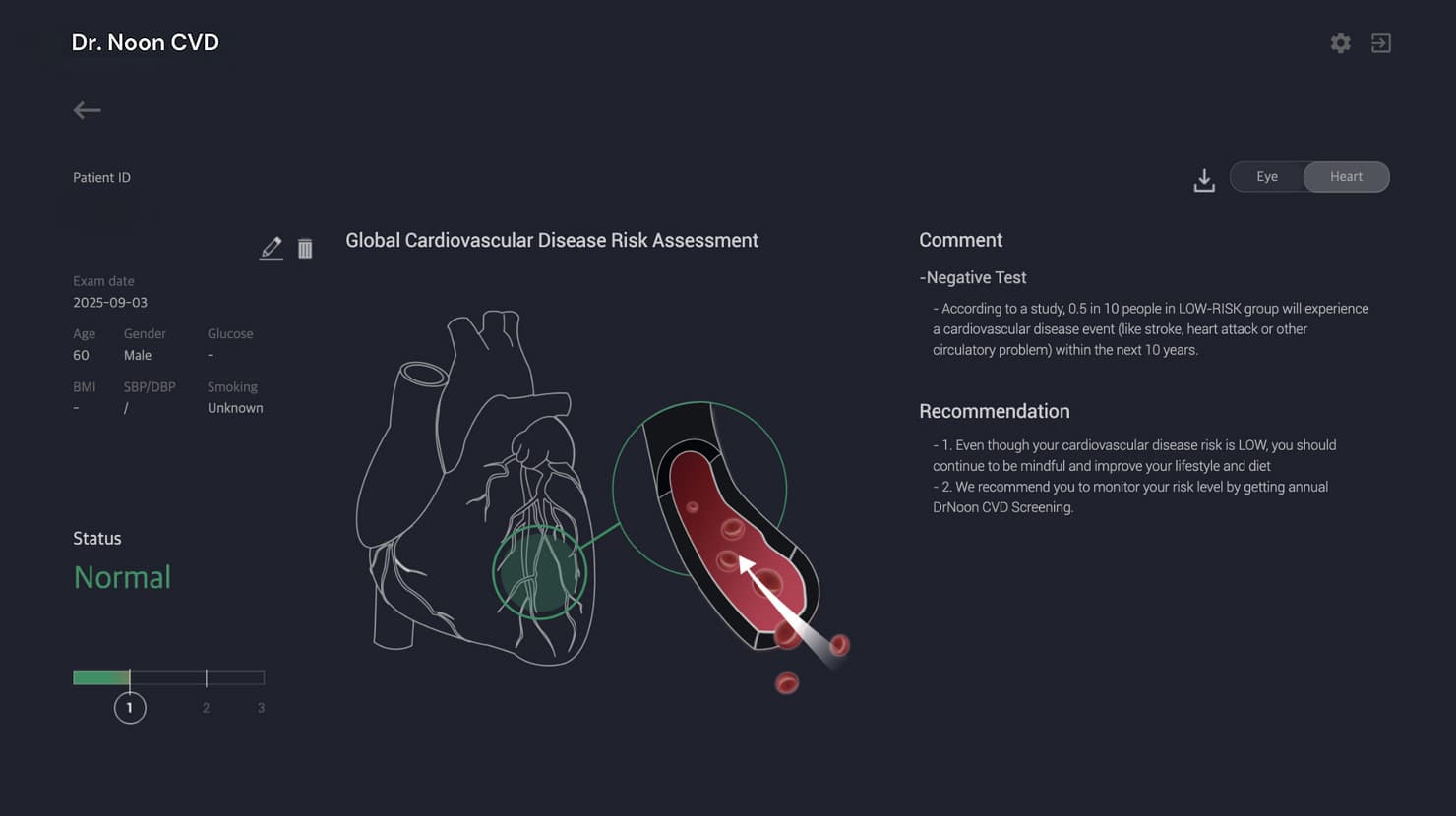 An example Dr.Noon CVD cardiovascular-risk report showing risk status, explanation and recommendations