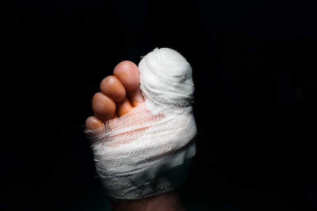 Diabetic-foot assessment — a key use of non-invasive arterial screening
