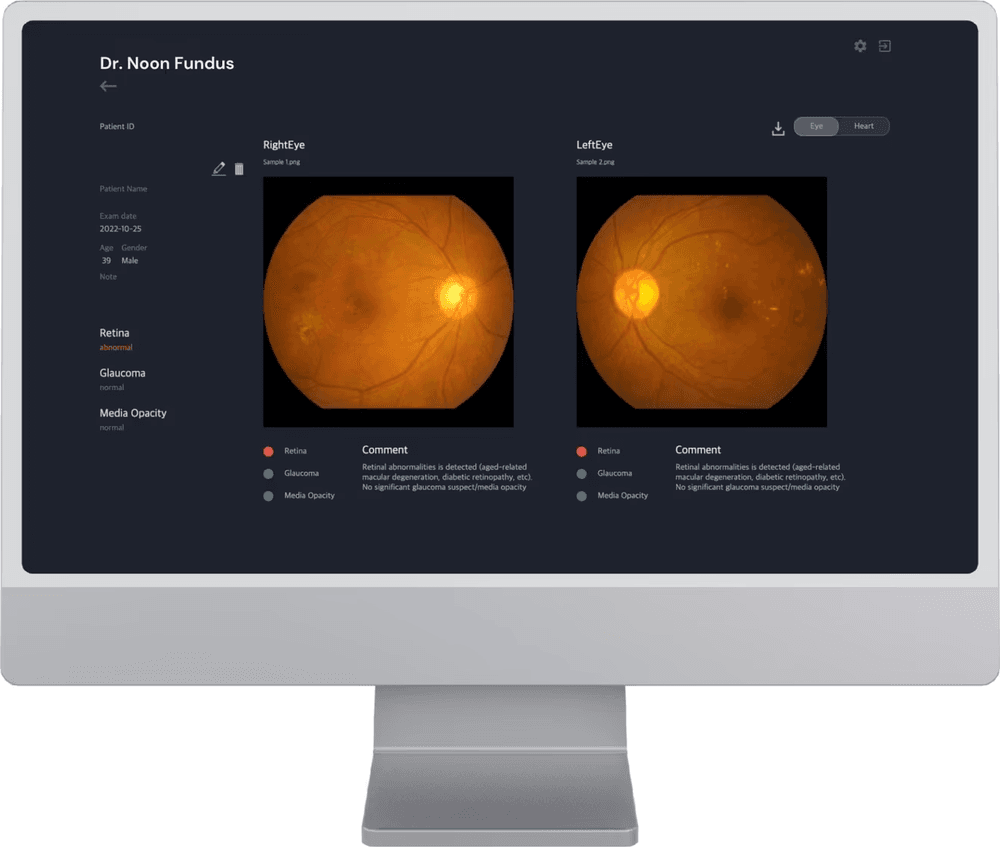 Dr.Noon by Mediwhale software analysing retinal scans for cardiovascular risk